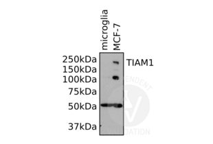 Western Blotting validation image for anti-T-Cell Lymphoma Invasion and Metastasis 1 (TIAM1) (AA 1-378) antibody (ABIN1982879) (TIAM1 Antikörper  (AA 1-378))