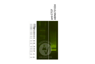 Cleavage Under Targets and Release Using Nuclease validation image for anti-CCCTC-Binding Factor (Zinc Finger Protein) (CTCF) antibody (ABIN6731034)