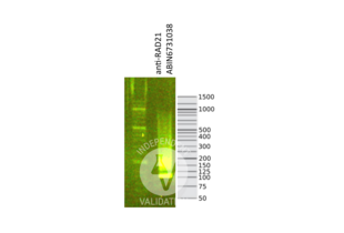 Cleavage Under Targets and Release Using Nuclease validation image for anti-RAD21 Homolog (RAD21) (N-Term) antibody (Sortase,His tag,AVI tag) (ABIN6731038) (Rekombinanter RAD21 Antikörper  (N-Term) (Sortase,His tag,AVI tag))