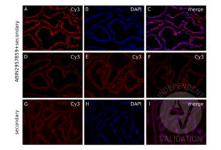 Immunofluorescence validation image for anti-Androgen Receptor (AR) (Center) antibody (ABIN2957859)