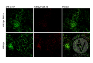 Immunofluorescence validation image for anti-Four and A Half LIM Domains 1 (FHL1) antibody (ABIN2966633)