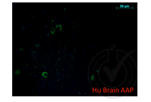 Figure 1. Micrograph image of positive control (human brain FFPE tissue). APP staining appears in green.