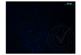 Figure 2: micrograph image of negative control (human liver FFPE tissue) stained with APP antibody.