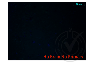 Figure 4: micrograph image of secondary antibody only control (no primary antibody on human brain FFPE tissue).
