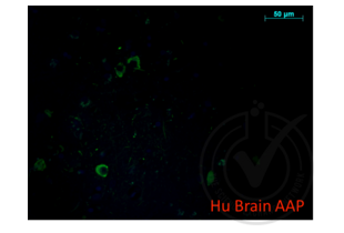 Immunofluorescence validation image for anti-Amyloid beta (A4) Precursor Protein (APP) (AA 666-670) antibody (ABIN197433) (APP Antikörper  (AA 666-670))