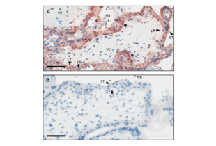 Immunohistochemistry validation image for anti-Keyhole Limpet Hemocyanin (KLH) antibody (ABIN401183)