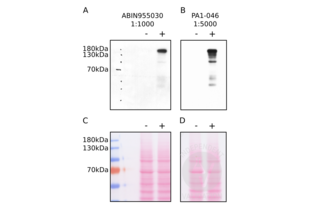 Western Blotting validation image for anti-Synaptic Ras GTPase Activating Protein 1 (SYNGAP1) (AA 1169-1183), (Internal Region) antibody (ABIN955030) (SYNGAP1 Antikörper  (Internal Region))