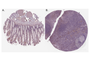 Immunohistochemistry validation image for anti-Insulin Receptor Substrate 1 (IRS1) (AA 106-122), (N-Term) antibody (ABIN3042564) (IRS1 Antikörper  (N-Term))