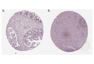 Immunohistochemistry validation image for anti-Mucosal Vascular Addressin Cell Adhesion Molecule 1 (MADCAM1) (AA 173-190), (Middle Region) antibody (ABIN3044076)