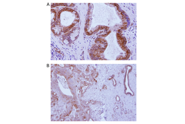 STING/TMEM173 Antikörper  (C-Term)