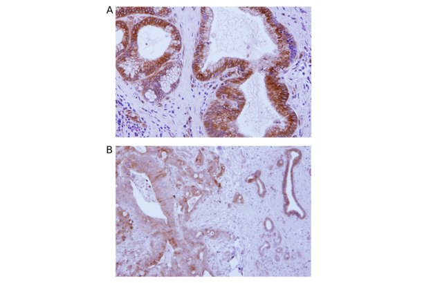 STING/TMEM173 anticorps  (C-Term)