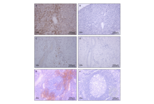 Immunostaining of IL8 in human liver liver (A), testicle (C), and tonsil sections (D) using ABIN1724413 compared to unstained sections of the same tissues (B, D, F). Magnification factors and the respective scale are indicated.