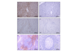 Immunohistochemistry validation image for anti-Interleukin 8 (IL8) antibody (ABIN1724413)