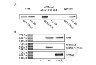 Western Blotting validation image for anti-Nucleophosmin (Nucleolar phosphoprotein B23, Numatrin) (NPM1) (AA 250-298), (C-Term) antibody (ABIN1737584)
