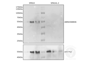 Different volumes of lysates from NIH/3T3 cells ectopically expressing SPAG4 (lanes 1-3) or SPAG4L-2 (lanes 5-7) were loaded and the blot membrane was incubated with ABIN4368846 (upper panel). Ectopically expressed proteins were subsequently detected using an anti-myc-tag antibody. Expected molecular masses of SPAG4 and SPAG4L-2 are approximately 50kDa.