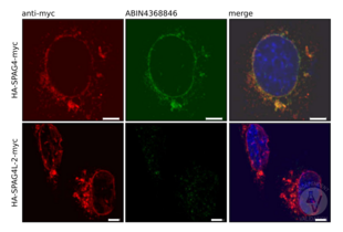 NIH/3T3 cells expressing myc-tagged Spag4 (upper row) or Spag4L-2 (lower row) were incubated with an anti-myc tag antibody (left, red) or anti-SPAG4 antibody (middle, green). The pictures on the right show the red and green channels merged with DAPI counterstatin (blue).