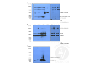 A. Western blot analysis using ABIN654696 of ORMDL1, ORMDL2 and ORMDL3 expression in total lysates from Jurkat cells (1), Jurkat cells stably expressing ORMDL3-HA (2),  Flp-In T-Rex HEK293 cells with fusion SPT without and with tetracycline (3 and 4),  293T cells with pcDNA3.1 (5), HEK cells with NubG-HA tagged ORMDL1 (6), 2 (7) or 3 (8), transiently transfected with pCMVAC-ORMDL1-GFP (9), and purified ORMDL1-GFP (10), ORMDL2-GFP (11) and ORMDL3-GFP (12).  ORMDLs siRNA expression decreases endogenous ORMDLs protein in uninduced cells and in Flp-In T-Rex HEK293 cells harboring tet inducible SPT as revealed by western blot using ABIN654696 on lysates from Flp-In T-Rex HEK293 cells harboring Tet inducible SPT without Tet (13, 14) and with Tet (15) and all without siRNAs compared to cell lysates subsequently to siRNA ORMDL1, 2, and 3 knockdown without (16) or with Tet induction (17). B. Western blot analysis of the same lysates using anti-human LCB1 and GAPDH antibodies and C. an anti-HA antibody. 