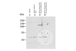 Western Blotting validation image for anti-Rhomboid 5 Homolog 2 (RHBDF2) (AA 80-109), (N-Term) antibody (ABIN2846535)