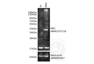 Lysates from human MR1-expressing HEK293 cells (MR1) and vector control cells (Vc) were resolved on a 10% SDS-PAGE gel for Western blotting analysis using antibodies specific for MR1 (ABIN1537116) and beta-actin (ABIN962807). 