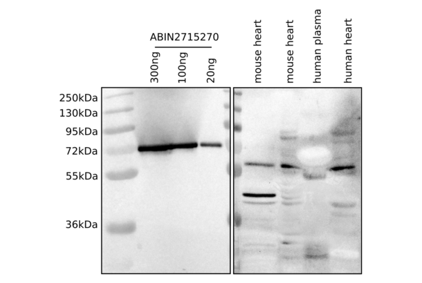 BIN1 Protein (Transcript Variant 8) (Myc-DYKDDDDK Tag)
