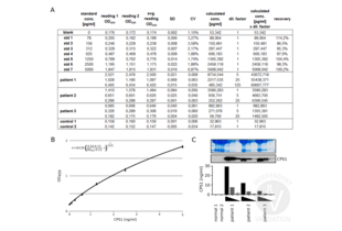 A. Standard curve and sample measurements using ABIN1125223. B. The standard curves for the assays reported were fitted with a 4-Parameter Logistic model, giving good quality fits (R2=0.999). C. CPS1 level comparison determined by western blotting and ABIN1125223. Normal serum from healthy humans was used undiluted. Serum from patient 1 was used undiluted, 1:5, and 1:25 diluted (middle panel). Sera from patient 2 and patient 3 were used at 1:5, 1:25, and 1:125 dilutions. 2µl of serum was used for Western blotting; presence of proteins was verified by Commassie staining (upper panel). The graph illustrates the ELISA results. 