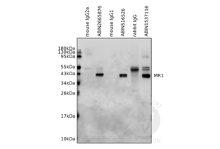 Immunoprecipitation validation image for anti-Major Histocompatibility Complex, Class I-Related (MR1) (AA 201-300) antibody (ABIN516526)