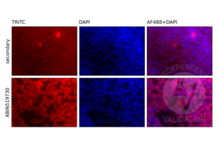 Immunofluorescence validation image for anti-V-Rel Reticuloendotheliosis Viral Oncogene Homolog B (RELB) (AA 1-579) antibody (ABIN519730)