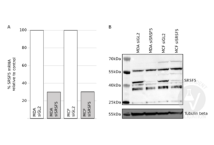 Western Blotting validation image for anti-serine/arginine-Rich Splicing Factor 5 (SRSF5) (AA 1-272) antibody (ABIN948457)