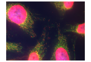 Immunocytochemistry validation image for anti-Chromosome 10 Open Reading Frame 2 (C10ORF2) (Middle Region) antibody (ABIN2775251) (C10orf2 Antikörper  (Middle Region))