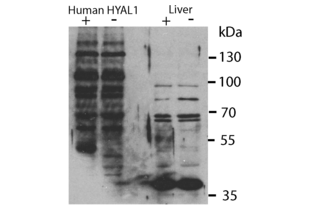 Western blot analysis of human HYAL1 overexpressed (first lane) in Hyal1 -/- MEFs (second lane). The two right lanes show detection enodgenous Hyal1 in mouse liver samples from Hyal1 +/+ (third lane) or Hyal1 -/- (fourth lane).