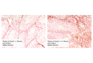 Testes of Hyal1 -/- mouse (A) or Hyal1 +/+ mouse (B) stained with ABIN2784342 as described in the protocol.