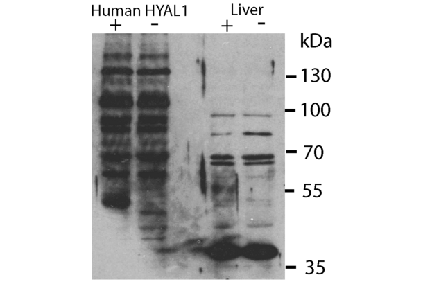 HYAL1 antibody  (N-Term)