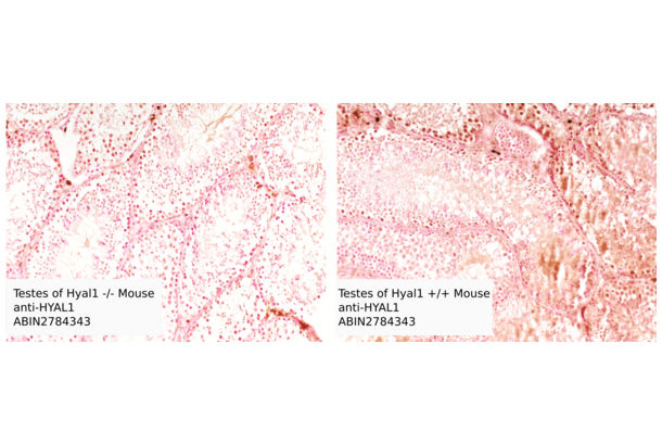 HYAL1 antibody  (N-Term)