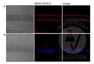 Immunohistochemistry validation image for anti-Nardilysin (N-Arginine Dibasic Convertase) (NRD1) (Middle Region) antibody (ABIN2787813)