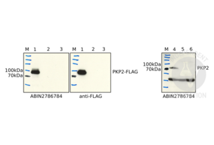 Plakophilin 2 anticorps  (N-Term)