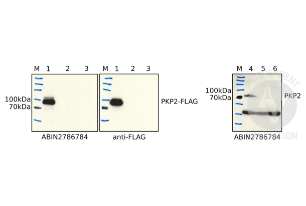 Plakophilin 2 anticorps  (N-Term)