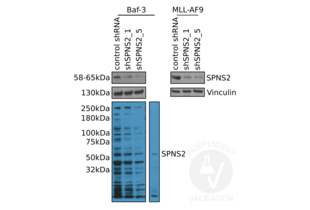 Western blot analysis of SPNS2 expression in mouse Baf-3 (left) and MLL-AF9 cells (right) using ABIN2786494. Cells were transduced either with a control shRNA (control shRNA) or one of two SPNS2 shRNA (shSPNS2_1 and shSPNS2_5). 
