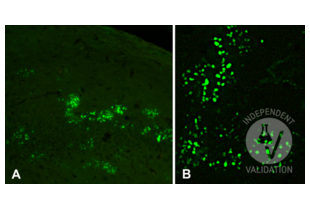 5-methyl-cytosine immunoreactive neuronal nuclei in the mouse forebrain. A: a group of immunoreactive nuclei in the deep layers of the cerebral cortex (original magnification 20x); B: at higher magnification (40x), the positive 5-methyl-cytosine sites are visible in the form of a punctate reaction. Primary antibody dilution: 1:100. No microwave.