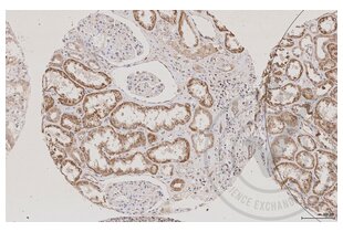 Immunohistochemistry validation image for anti-Aquaporin 2 (Collecting Duct) (AQP2) (AA 171-271) antibody (ABIN707576)