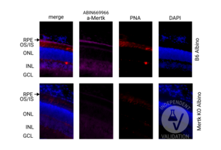 Immunohistochemistry validation image for anti-C-Mer Proto-Oncogene Tyrosine Kinase (MERTK) (AA 501-600) antibody (ABIN669966)