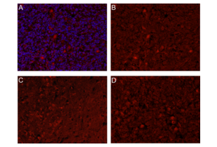 Immunohistochemistry (Formalin-fixed Paraffin-embedded Sections) validation image for anti-C-Type Lectin Domain Family 14, Member A (CLEC14A) (AA 260-310) antibody (ABIN1385496)