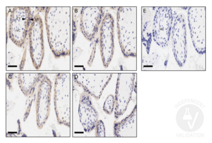 Immunohistochemistry validation image for anti-CD200 (CD200) (AA 41-140) antibody (ABIN761396)