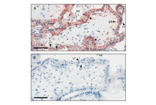 Immunohistochemistry validation image for anti-CD200 Receptor 1-Like (CD200R1L) (AA 151-250) antibody (ABIN1715098)