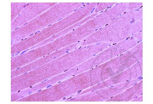 Immunohistochemistry validation image for anti-CD4 (CD4) (AA 385-457) antibody (ABIN671376)