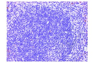 Immunohistochemistry validation image for anti-CD4 (CD4) (AA 385-457) antibody (ABIN671376)