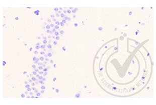 Immunohistochemistry validation image for anti-Coagulation Factor III (thromboplastin, Tissue Factor) (F3) (AA 32-100) antibody (ABIN708086)