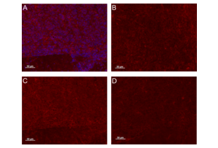 Immunohistochemistry (Formalin-fixed Paraffin-embedded Sections) validation image for anti-EGF, Latrophilin and Seven Transmembrane Domain Containing 1 (ELTD1) (AA 301-400) antibody (ABIN1713780)