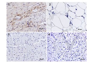 Immunohistochemistry validation image for anti-Elastin (ELN) (AA 681-786) antibody (ABIN734003)