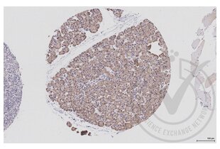 Immunohistochemistry validation image for anti-Eukaryotic Translation Initiation Factor 4E (EIF4E) (AA 121-217) antibody (ABIN1386772)