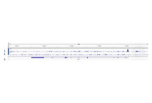 1. Alignment tracks from CUT&RUN targeting FOXO1 in mouse fore limb (11.5) cells using anti-FOXO1 antibody ABIN1387620, showing the Gtf2a1 locus. 2. Alignment tracks using negative control IgG, ABIN101961. 3. RefSeq Genes.